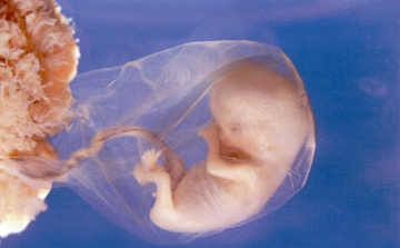 ET-ombudsman: törvényben kell megtiltani a magzat neme miatti abortuszt