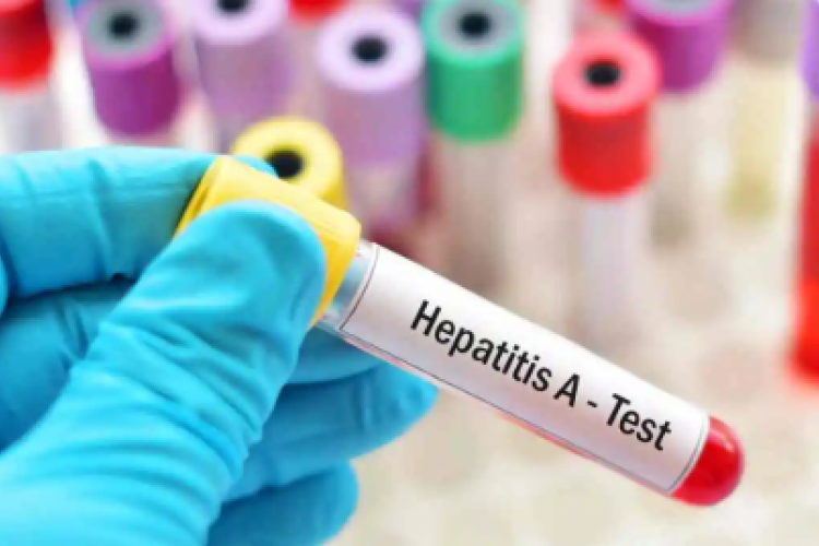 Népegészségügyi központ: dinamikusan emelkedik a hepatitis A-val fertőzöttek száma